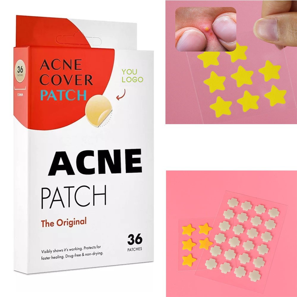 acnetreatment