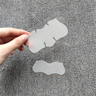 הסרת רצועות חטט באף